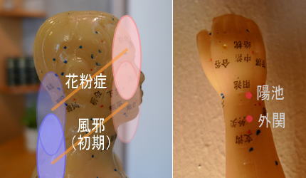 花粉症と風邪