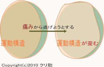 痛みから逃げる