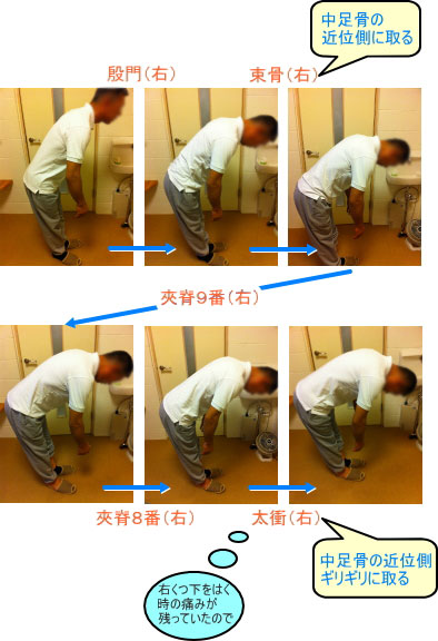 症例_ぎっくり腰の症例