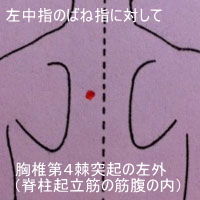 ばね指の改善例(解説付き)