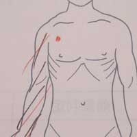右腕全体のしびれ