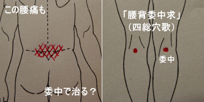 腰痛のツボは委中ですが…