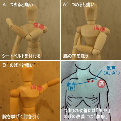 五十肩とツボ