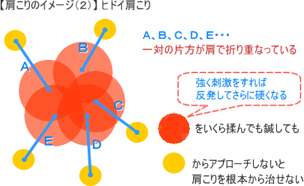 肩こりのイメージ２