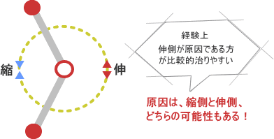 鍼灸で縮みと伸びをコントロールする
