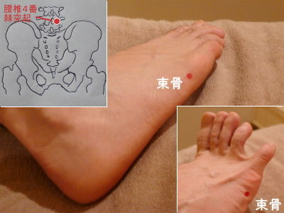 腰椎と束骨