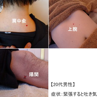 20代男性患者