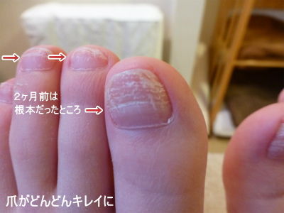 爪の変化