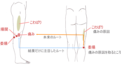 膝外側痛