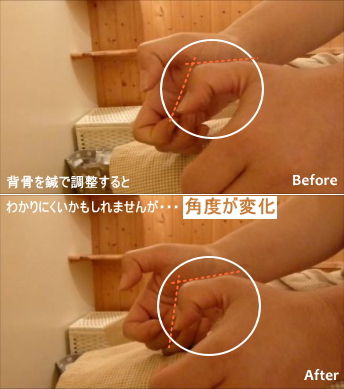 背骨で指の角度が変化