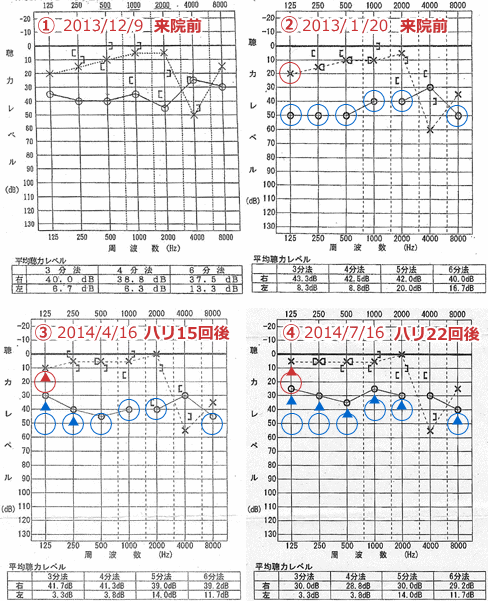 YMTS050214