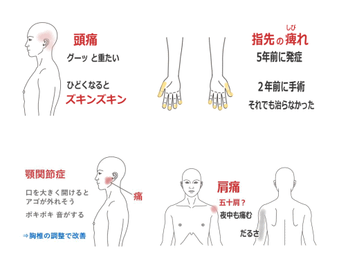 鍼灸の症例図（サンプル）