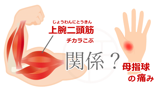 上腕二頭筋と母指球の痛みの関係
