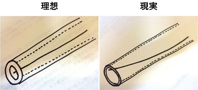 鍼管の理想と現実を比較する