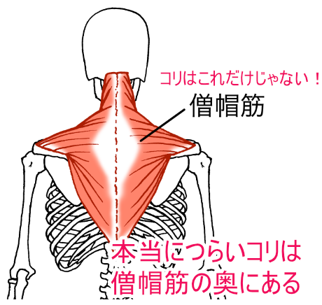 肩こりの原因は僧帽筋だけじゃない"