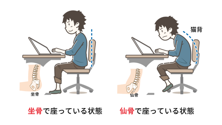 骨盤の傾きと姿勢の関係