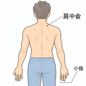 肩中兪に鍼をしたら小指のしびれがとれた